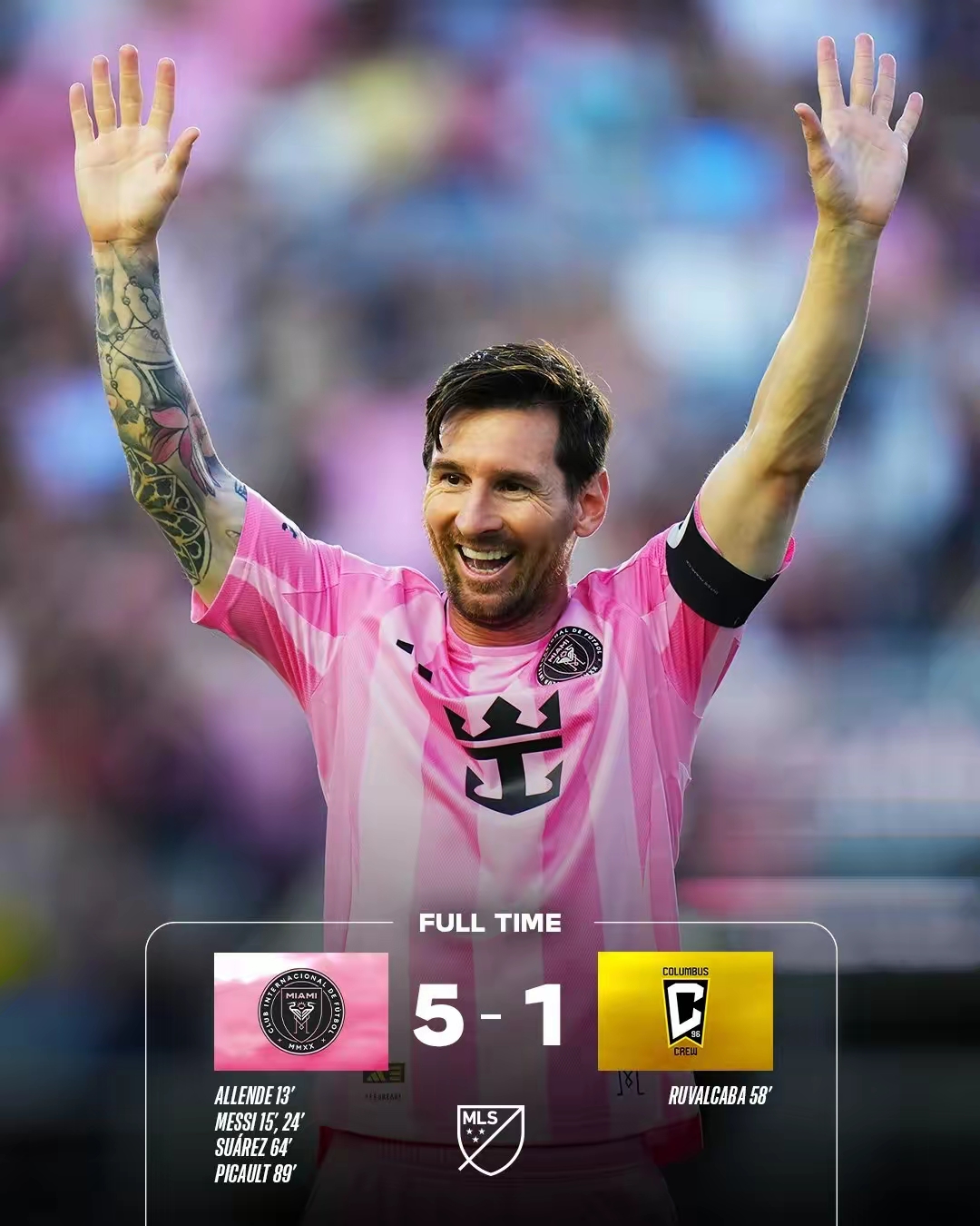 包含哥伦比亚球星突破伤病困扰,将复出比赛的词条 包含哥伦比亚球星突破伤病困扰,将复出比赛的词条